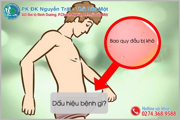 Bao quy đầu bị khô là dấu hiệu bệnh gì?