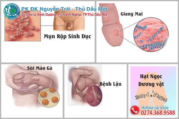 Bệnh xã hội ở nam giới