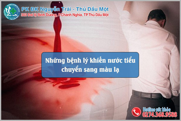 Những bệnh lý khiến nước tiểu chuyển sang màu lạ