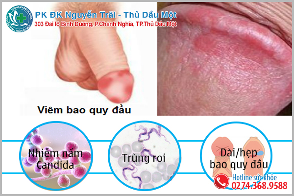 Quy đầu nổi mẫn đỏ có thể là do các bệnh lý nam khoa