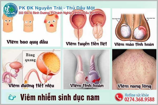 Viêm nhiễm sinh dục nam tiềm ẩn mối nguy hại đến sức khỏe của nam giới