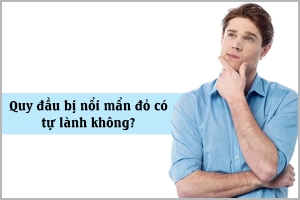 Quy đầu bị nổi mẩn đỏ có tự lành không?