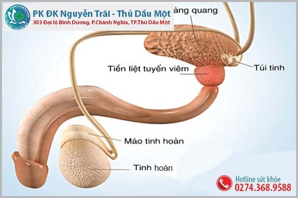 Những tác hại viêm túi tinh không nên bỏ qua