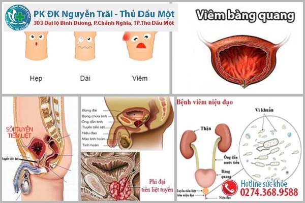 Tiểu khó do bệnh gì gây ra?