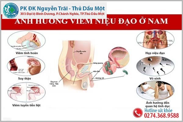 Viêm niệu đạo nam giới nổi khổ của các anh em