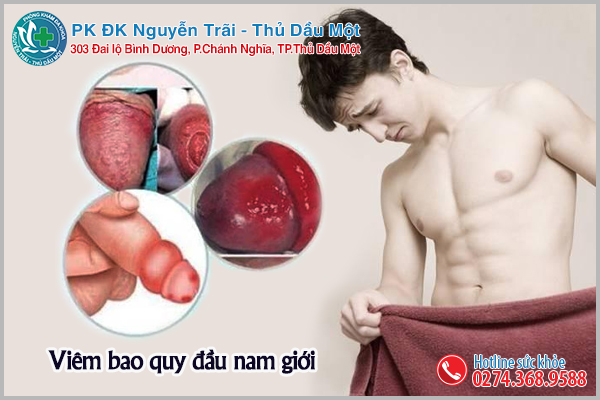 viêm bao quy đầu