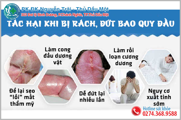 ảnh hưởng đứt bao quy đầu