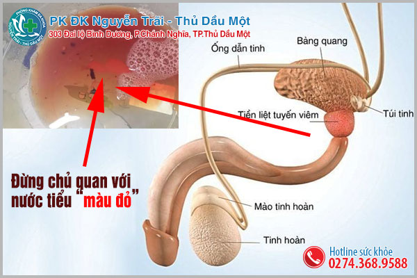 Nước tiểu màu đỏ